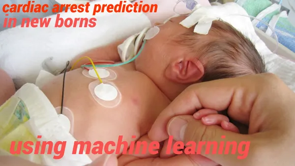 cardiac arrest prediction using machine learning