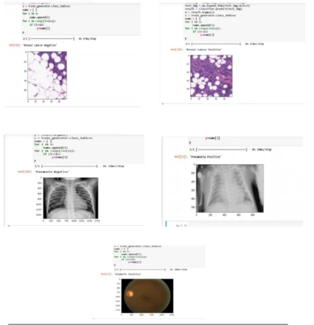 Disease Prediction Using Machine Learning  and deep learning Techniques