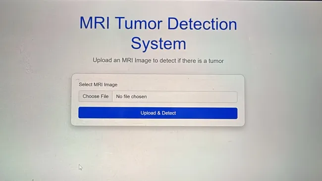 Brain Tumor Detection
