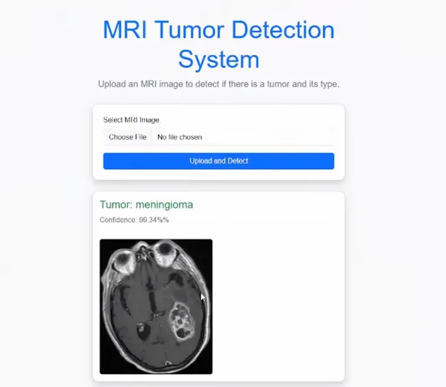 Brain Tumor Detection